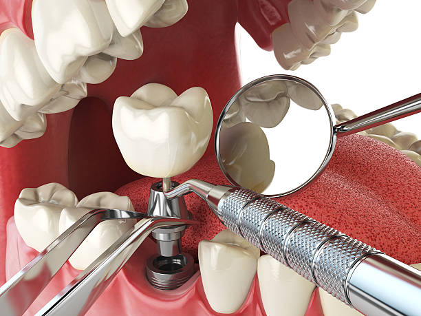 Best Orthodontic Emergency Dentist in Flying Hills, PA